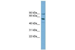 ALOX15B antibody used at 0. (ALOX15B anticorps  (Middle Region))