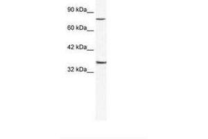 Image no. 1 for anti-Zinc Finger Protein 337 (ZNF337) (AA 288-337) antibody (ABIN202900) (ZNF337 anticorps  (AA 288-337))