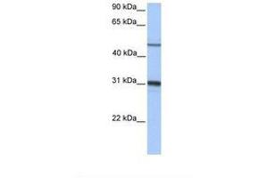 Image no. 1 for anti-Epoxide Hydrolase 1, Microsomal (Xenobiotic) (EPHX1) (AA 182-231) antibody (ABIN6738923) (EPHX1 anticorps  (AA 182-231))