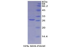SDS-PAGE of Protein Standard from the Kit  (Highly purified E. (CD25 Kit ELISA)