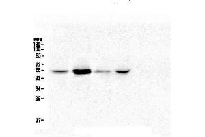 Western blot analysis of RbAp48 using anti-RbAp48 antibody (ABIN5692929). (Retinoblastoma Binding Protein 4 anticorps  (C-Term))