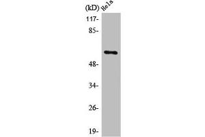 Western Blot analysis of COLO205 cells using PLK-5 Polyclonal Antibody (PLK5 anticorps  (Internal Region))