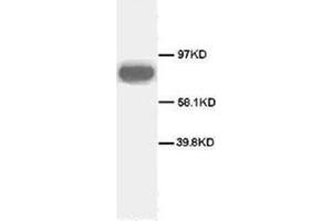 Western blot analysis of rat spleen sections using CD71 antibody (Transferrin Receptor anticorps  (C-Term))