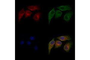 ABIN6264766 and ABIN6277226 staining Hela cells by IF/ICC. (RIPK2 anticorps  (N-Term))