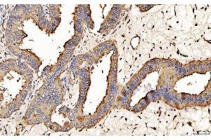 IHC analysis of PDIA6 using anti-PDIA6 antibody (ABIN7600554). (PDIA6 anticorps  (AA 20-440))