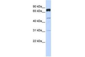 Image no. 1 for anti-Pleckstrin Homology Domain Containing, Family A (phosphoinositide Binding Specific) Member 4 (PLEKHA4) (AA 504-553) antibody (ABIN6740774) (PLEKHA4 anticorps  (AA 504-553))