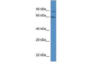 WB Suggested Anti-MUS81 AntibodyTitration: 1. (MUS81 anticorps  (Middle Region))