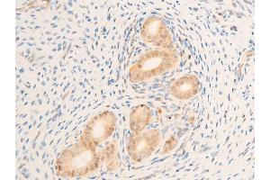 ABIN6267236 at 1/100 staining rat uterine tissue sections by IHC-P.