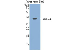 Detection of Recombinant ITGb3, Mouse using Polyclonal Antibody to Integrin Beta 3 (ITGb3) (Integrin beta 3 anticorps  (AA 134-376))