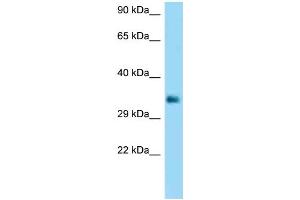 WB Suggested Anti-FCGR2B Antibody Titration: 1. (FCGR2B anticorps  (C-Term))