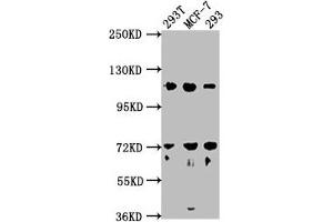 Western Blot Positive WB detected in: 293T whole cell lysate, MCF-7 whole cell lysate, 293 whole cell lysate All lanes: WDR59 antibody at 1:2000 Secondary Goat polyclonal to rabbit IgG at 1/50000 dilution Predicted band size: 110, 65, 63, 47 kDa Observed band size: 110 kDa (WDR59 anticorps  (AA 619-862))