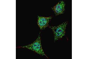 Fluorescent confocal image of HeLa cells stained with phospho-Bad-S99 antibody.