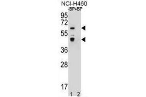 Western blot analysis of PRAMEF3 Antibody (C-term) Pab pre-incubated without(lane 1) and with(lane 2) blocking peptide in NCI-H460 cell line lysate. (PRAMEF3 anticorps  (C-Term))