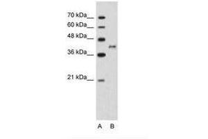 Image no. 1 for anti-Bradykinin Receptor B2 (BDKRB2) (N-Term) antibody (ABIN203497) (BDKRB2 anticorps  (N-Term))
