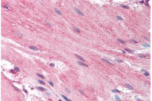 Human Small Intestine, Smooth Muscle (formalin-fixed, paraffin-embedded) stained with HRH1 antibody ABIN297157 at 2. (HRH1 anticorps  (AA 471-484))
