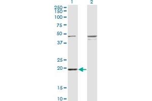 Western Blot analysis of RBBP9 expression in transfected 293T cell line by RBBP9 monoclonal antibody (M03A), clone 3H4. (RBBP9 anticorps  (AA 1-186))