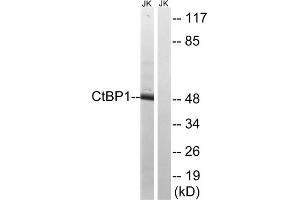 Western blot analysis of extracts from Jurkat cells, using CtBP1 (epitope around residue 422) antibody. (CTBP1 anticorps  (Ser422))