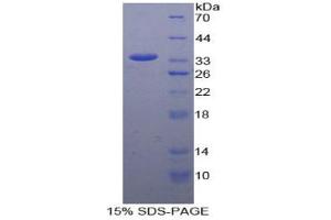 SDS-PAGE analysis of Human CCDC80 Protein. (CCDC80 Protéine)