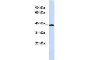 WB Suggested Anti-XRCC4 Antibody Titration:  0.