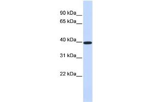 WB Suggested Anti-XRCC4 Antibody Titration:  0. (XRCC4 anticorps  (Middle Region))