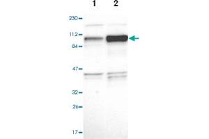 Western blot analysis of Lane 1: Human cell line RT-4, Lane 2: Human cell line U-251MG sp with NCAPH polyclonal antibody  at 1:100-1:250 dilution. (NCAPH anticorps)