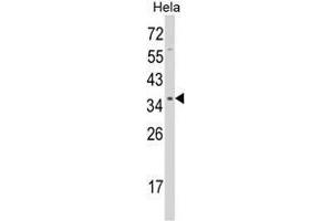 Western blot analysis of STRAP Antibody (C-term) in Hela cell line lysates (35ug/lane). (STRAP anticorps  (C-Term))
