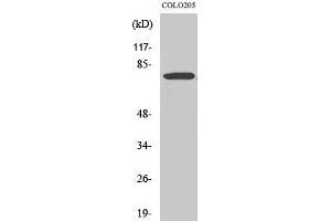 Western Blot (WB) analysis of COLO205 cells using EWS Polyclonal Antibody. (EWSR1 anticorps  (Internal Region))