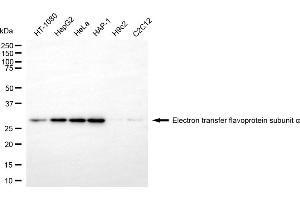 Western blotting analysis using electron transfer flavoprotein subunit alpha antibody (ABIN7798431). (ETFA anticorps)