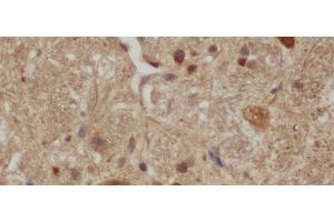 Immunohistochemistry of paraffin-embedded Mouse brain using Aβ40 Polyclonal Antibody at dilution of 1:50 (Abeta 1-40 anticorps)