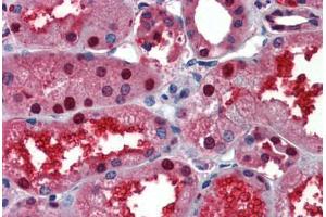 Human Kidney (formalin-fixed, paraffin-embedded) stained with LASS2 antibody ABIN462181 followed by biotinylated goat anti-rabbit IgG secondary antibody ABIN481713, alkaline phosphatase-streptavidin and chromogen.