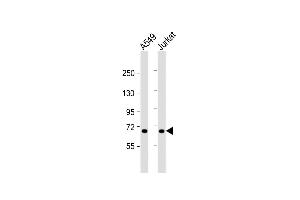 All lanes : Anti-F11 Antibody (Center) at 1:1000 dilution Lane 1: A549 whole cell lysate Lane 2: Jurkat whole cell lysate Lysates/proteins at 20 μg per lane. (Factor XI anticorps  (AA 281-307))