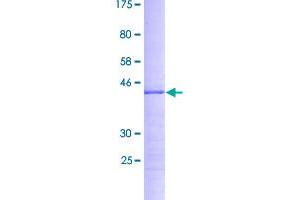 Image no. 1 for Ribosomal Protein S19 Binding Protein 1 (RPS19BP1) (AA 1-136) protein (GST tag) (ABIN1318763)