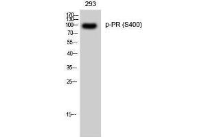 Western Blotting (WB) image for anti-PR (pSer400) antibody (ABIN3182420) (PR (pSer400) anticorps)