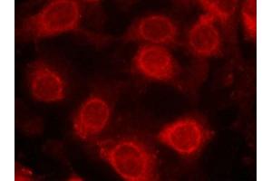Immunofluorescence staining of methanol-fixed MCF cells using eIF4E(Phospho-Ser209) Antibody. (EIF4E anticorps  (pSer209))