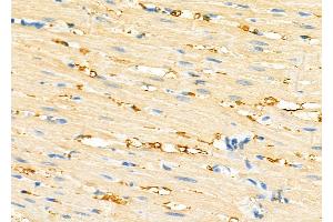 ABIN6262023 and ABIN6279475 at 1/100 staining Rat heart tissue by IHC-P.