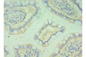 Immunohistochemistry of paraffin-embedded human small intestine tissue using ABIN7145826 at dilution of 1:100 (BOC anticorps  (AA 1-125))