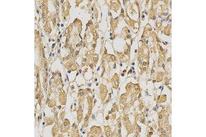 Immunohistochemistry of paraffin-embedded human stomach using PRDX4 antibody at dilution of 1:200 (x400 lens) (Peroxiredoxin 4 anticorps)