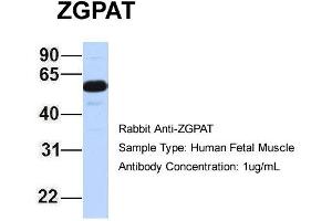 Host: Rabbit Target Name: ZGPAT Sample Type: Human Fetal Muscle Antibody Dilution: 1. (ZGPAT anticorps  (Middle Region))
