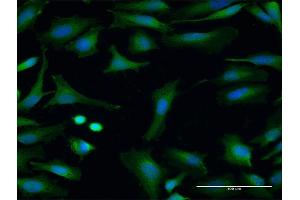 Immunofluorescence of purified MaxPab antibody to FMO3 on HeLa cell. (FMO3 anticorps  (AA 1-532))
