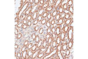 Immunohistochemistry of paraffin-embedded mouse kidney using KIF4A antibody (ABIN6128156, ABIN6142873, ABIN6142874 and ABIN6214349) at dilution of 1:100 (40x lens).