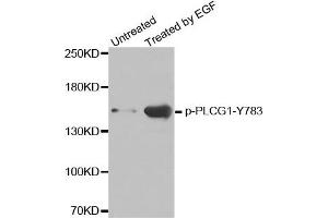 Western Blotting (WB) image for anti-phospholipase C, gamma 1 (PLCG1) (pTyr783) antibody (ABIN1870508) (Phospholipase C gamma 1 anticorps  (pTyr783))