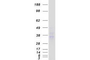 Validation with Western Blot