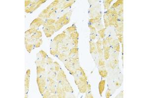 Immunohistochemistry of paraffin-embedded mouse heart using DDX3Y antibody (ABIN6130260, ABIN6139496, ABIN6139497 and ABIN6215395) at dilution of 1:100 (40x lens).