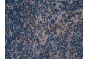 Detection of GAL9 in Mouse Spleen Tissue using Polyclonal Antibody to Galectin 9 (GAL9)