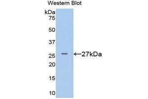 Western Blotting (WB) image for anti-FK506 Binding Protein 3, 25kDa (FKBP3) (AA 2-224) antibody (ABIN1078043)
