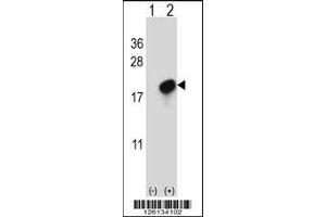 Western blot analysis of CMTM7 using rabbit polyclonal CMTM7 Antibody using 293 cell lysates (2 ug/lane) either nontransfected (Lane 1) or transiently transfected (Lane 2) with the CMTM7 gene. (CMTM7 anticorps  (N-Term))