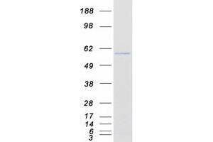 Validation with Western Blot