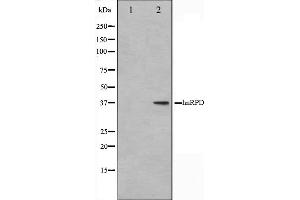 Western blot analysis on HuvEc cell lysate using hnRPD Antibody. (HNRNPD/AUF1 anticorps  (Internal Region))