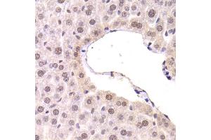 Immunohistochemistry of paraffin-embedded mouse liver using CDKN1A Antibody. (p21 anticorps)