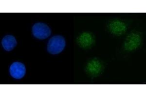 IF analysis of NPL4/NPLOC4 using anti-NPL4/NPLOC4 antibody (ABIN7599442). (NPLOC4 anticorps  (AA 1-495))